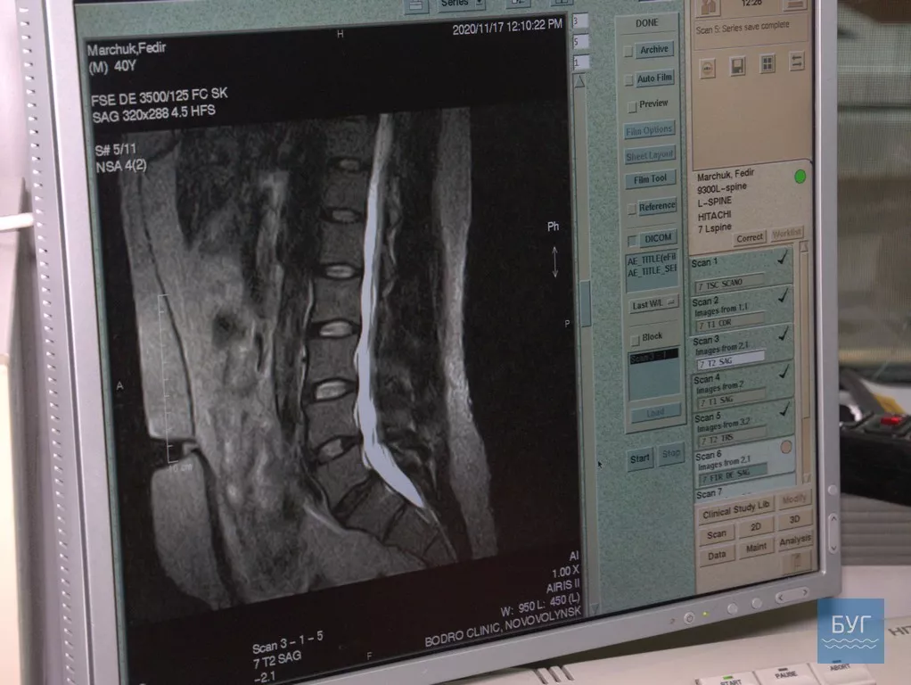 МРТ обстеження у Bodro clinic в Нововолинську пройшли близько 30 тисяч людей, - Сергій Крижановський 7