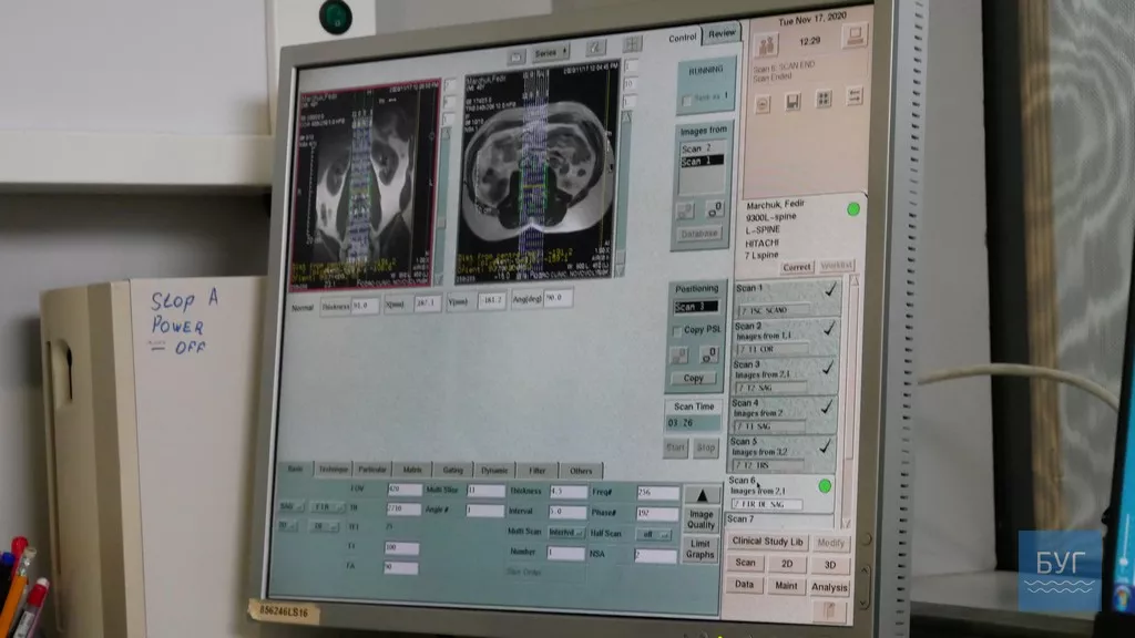 МРТ обстеження у Bodro clinic в Нововолинську пройшли близько 30 тисяч людей, - Сергій Крижановський 8