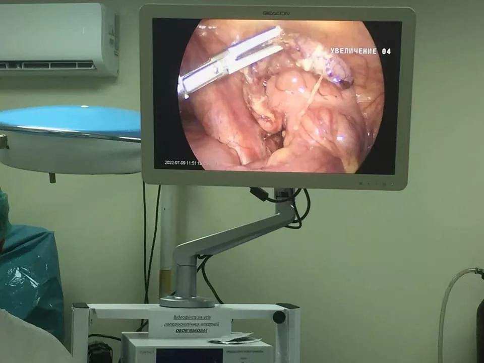 Хірурги ТМО Володимира видалили апендицит 7-річному хлопчику за допомогою новітнього обладнання 2