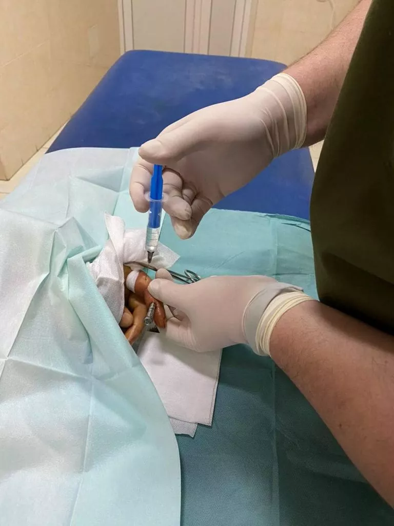 Чоловік закрутив шуруп собі у палець в Нововолинську 2