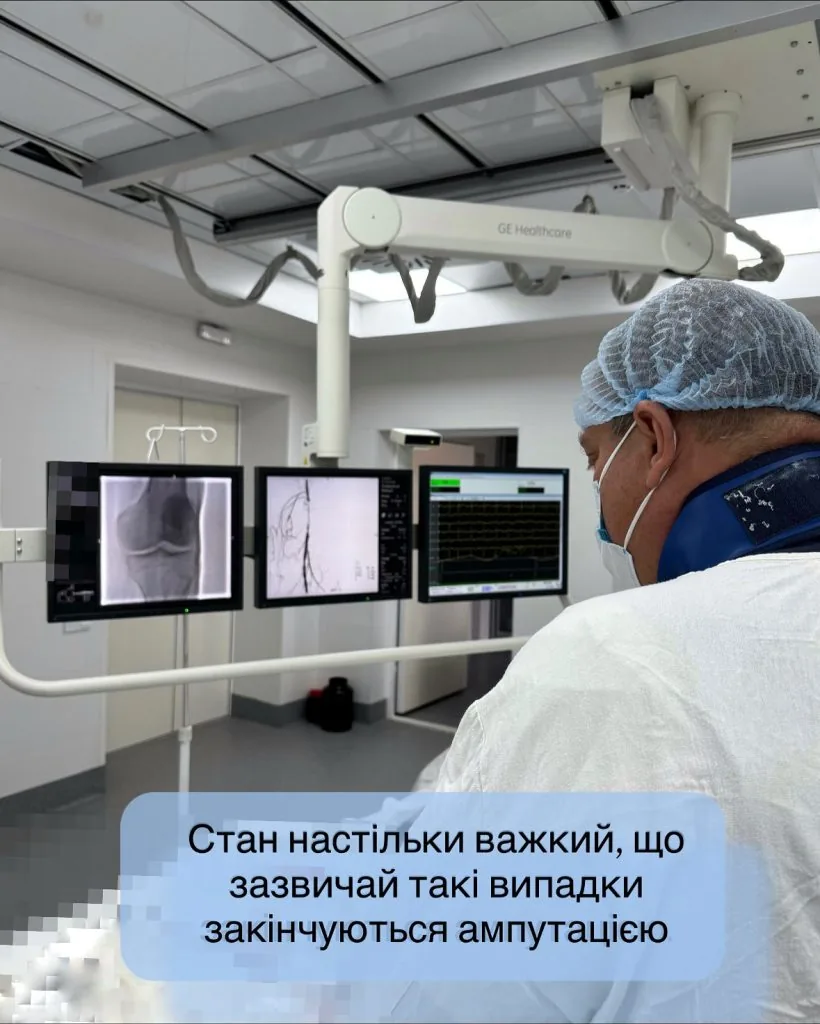 Кінцівка «ожила» на операційному столі: у Нововолинську медики врятували ногу пацієнта від ампутації 3